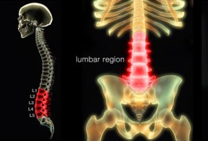 XRay