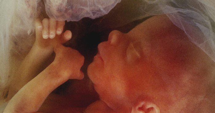 DNA Denial and the Rights of the Unborn